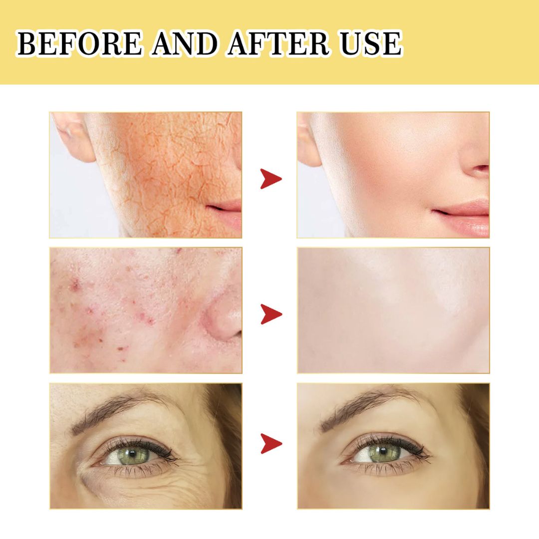 YouthLift™ Snail Peptide Power Essence